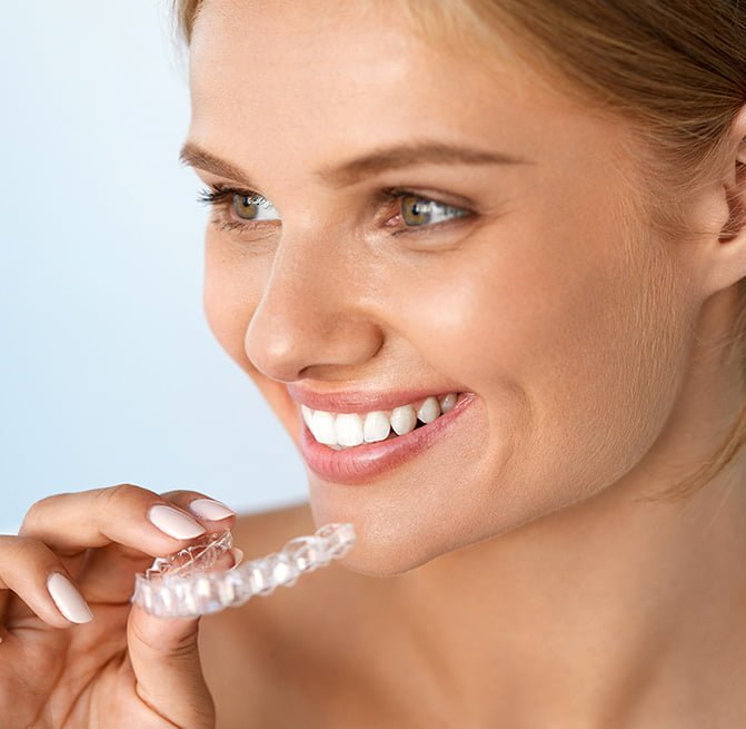 overbite teeth - invisalign in forest hill & Dulwich for overbite teeth - london dental arts clinic